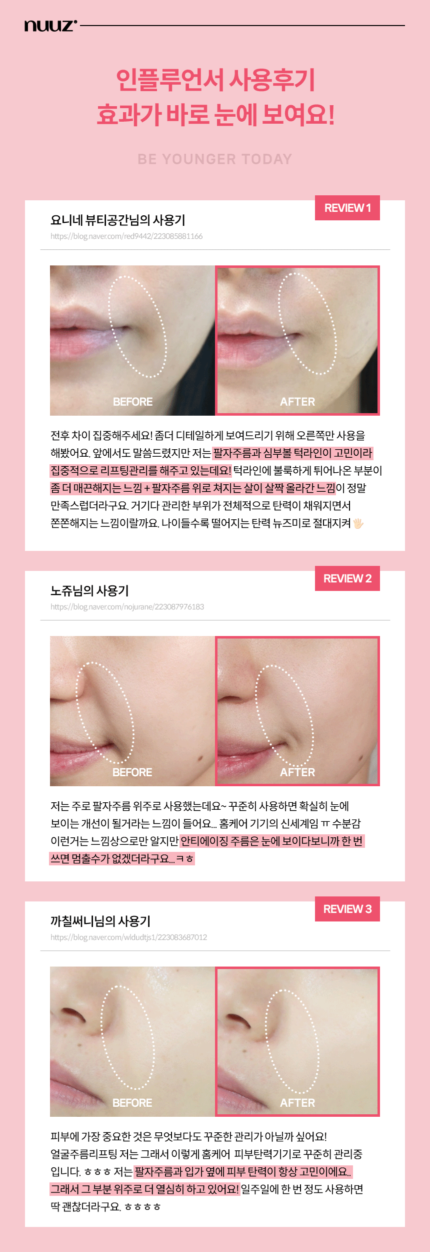 뉴즈미 한지민 nuuz me 뷰티디바이스 탄력샷기기 이미지 7
