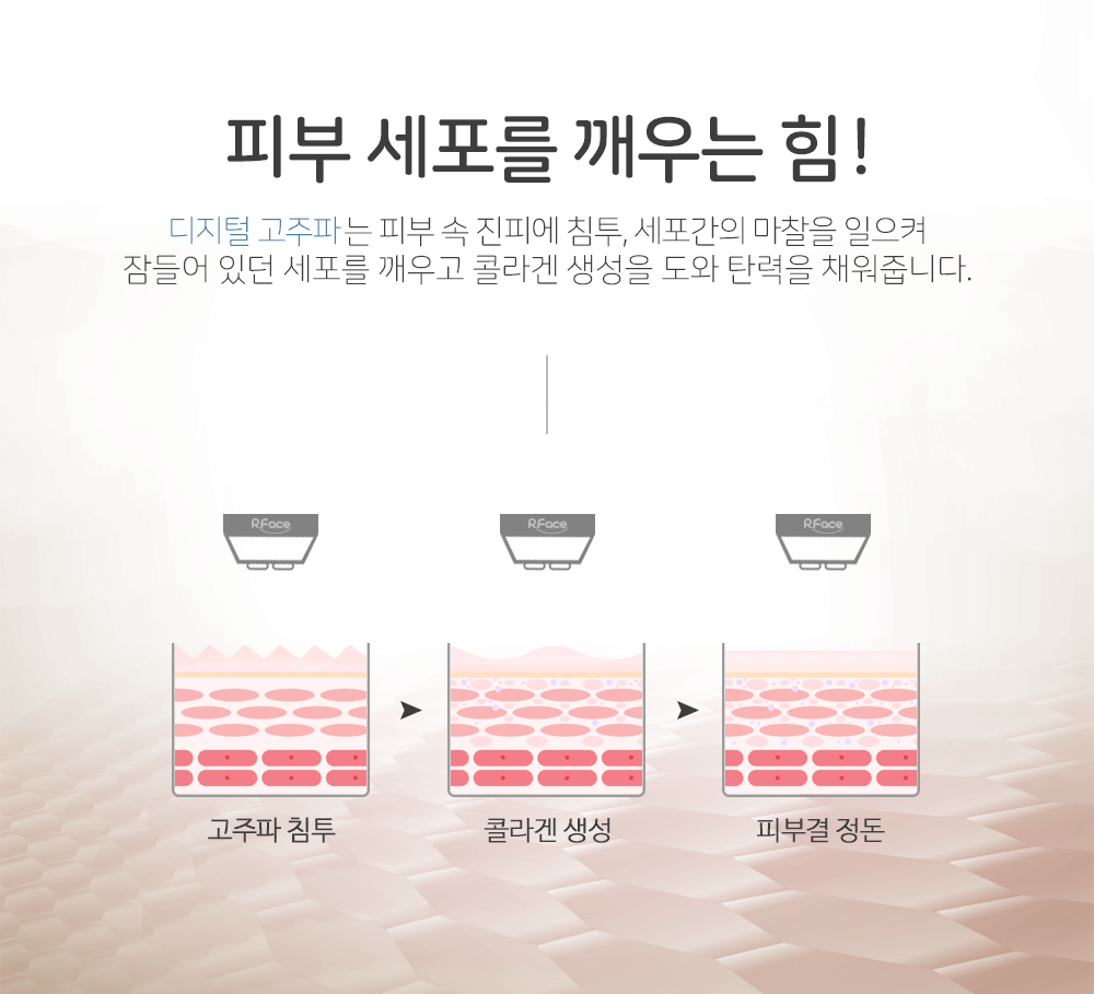 보탬 알페이스 고주파렌탈 이미지 5